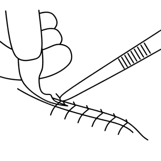 Suture.png